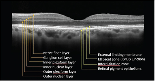 OCT Image with Retina Layers